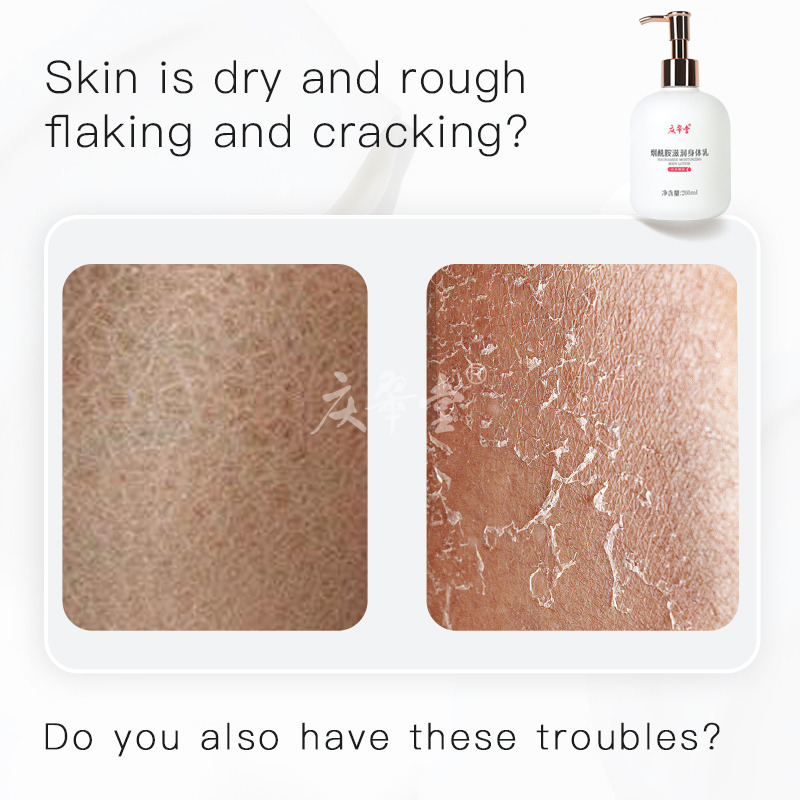 Niacinamide Moisturizing Body Lotion